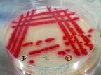 Bakterien- Vereinzelungsausstrich von roten Bakterium