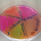Bakterien - Selektionsmedium zur Identifizierung von unterschiedlichen Bakterien logo