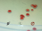 Bakterien- rote Kolonien aus einer Erdprobe